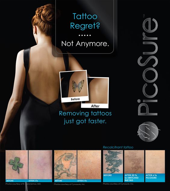 8d39e86fc6128b439c2bee2a8714fb45